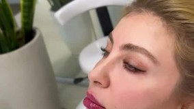 پیام معتمد، پزشک زیبایی