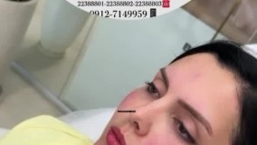 نمونه کار دکتر پیام معتمدی