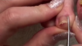 پدیکور-تکنیک های آموزش پدیکور-روش های جدید پدیکور-پیلینگ و لایه برداری