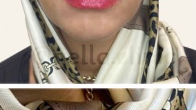 فرم دهی به لب