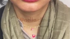 ژل لب به روش طبیعی