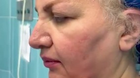 لیفت صورت- دکتر مجید نداف کرمانی