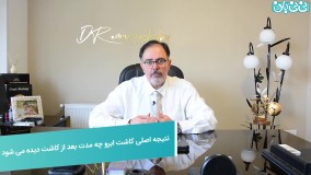 کاشت ابرو و نتیجه آن