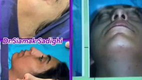 جراحی بینی- دکتر سیامک صدیقی