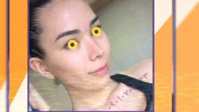 عمل بینی تهران