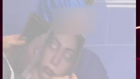 جراحی چانه (جینوپلاستی)