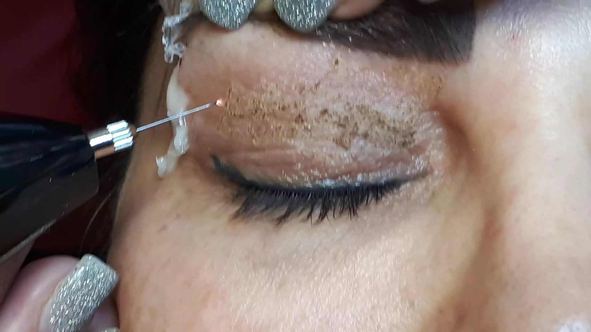 پلکسر پشت پلک