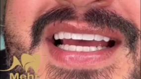 کلینیک دندانپزشکی مهر شریعتی