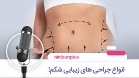 انواع جراحی های زیبایی شکم