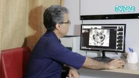 تفاوت هیستروسونگرافی و عکس رنگی رحم