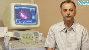 سقط جنین بخاطر تشخیص تترالوژی فالو