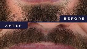 نمونه کار کلینیک دندانپزشکی حکیمان