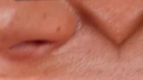 نمونه کار دندانپزشکی حکیمان