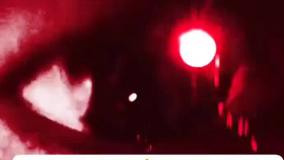 رایگان سریال زخم کاری ۱و۲ در لینک زیر👇