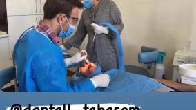 فیلم جراحی 13واحد ایمپلنت کره ای