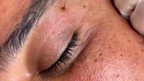 برداشت خال 1 2 3