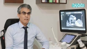 سونوگرافی NT