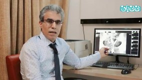 عکس رنگی رحم