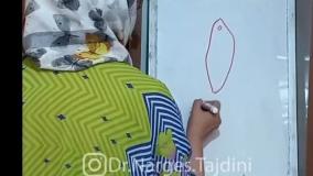 چطور بفهمم افتادگی واژن دارم؟