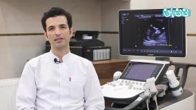 روش تشخیص سندروم داون در بارداری