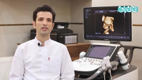 اهمیت سونوگرافی سه بعدی و چهاربعدی جنین