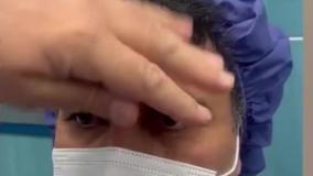 لیفت ابرو اندوسکوپیک و بلفاروپلاستی