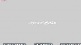 لیفت صورت در مشهد