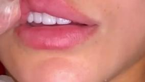 فیلم تزریق ژل لب مدل روسی