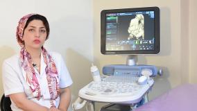 سونوگرافی بیوفیزیکال پروفایل