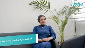 نتیجه عمل لابیاپلاستی