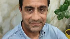 کاشت مو در کلینیک اورانوس