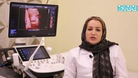 زمان انجام سونوگرافی آنومالی اسکن