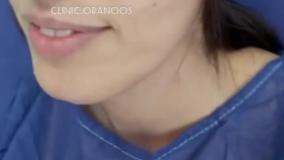 تزریق چربی در کلینیک اورانوس