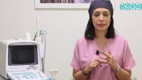 علائم تنبلی تخمدان یا تخمدان پلی کیستیک