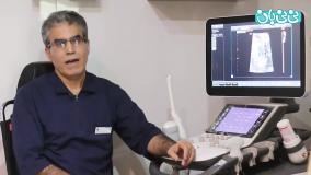 اکوکاردیوگرافی جنین