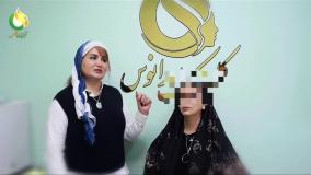 عوارض تزریق فیلر غیر استاندارد