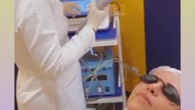 لیفت صورت و گردن بدون جراحی :