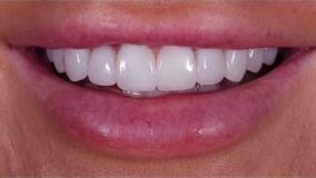 دكتر علی شجاعی فر - دندانپزشک زیبایی