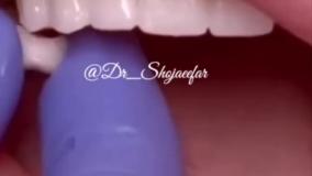 دكتر علی شجاعی فر - دندانپزشک زیبایی