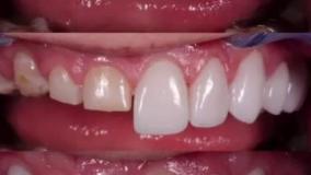 دكتر علی شجاعی فر - دندانپزشک زیبایی