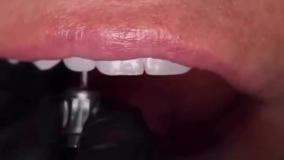 دكتر علی شجاعی فر - دندانپزشک زیبایی