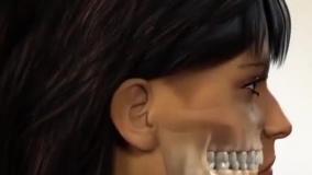 نحوه انجام جراحی فَک