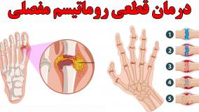 درمان قطعی روماتیسم مفصلی