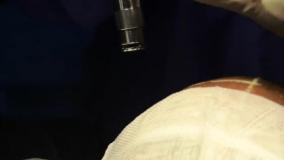 بهترین مرکز کاشت مو برای آقایان