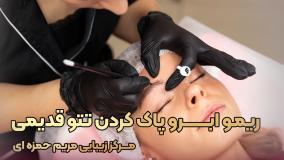 ریمو تتو ابرو در مرکز تخصصی میکروبلیدینگ مریم حمزه ای