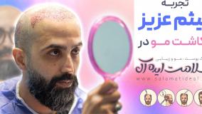 تجربه کاشت مو در کلینیک سلامت ایده آل