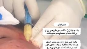 تزریق و جوانسازی پوست با دستگاه Bio Filler Maker