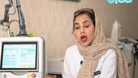 لیزر Co2 فرکشنال :