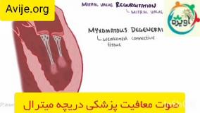 برای دریافت معافیت پزشکی پرولاپس دریچه ای قلب از کجا شروع کنیم؟