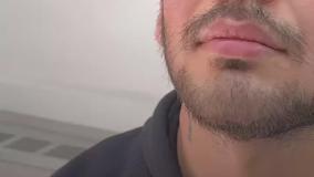 عمل بینی فانتزی مردانه در کلینیک مسیح